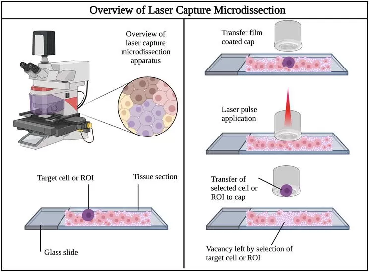 Overview of Laser Capture Microdissection (LCM)